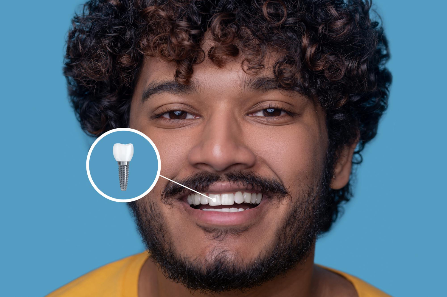 Dental Implants in jaipur dental seva