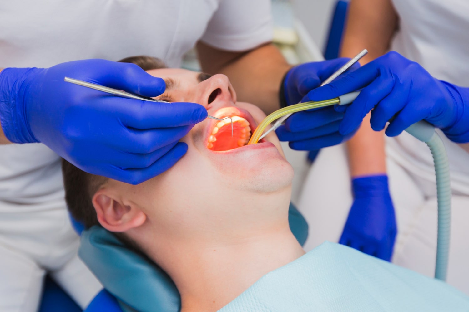 Root Canal Treatment in jaipur