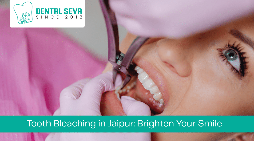 Tooth Bleaching in Jaipur: Brighten Your Smile