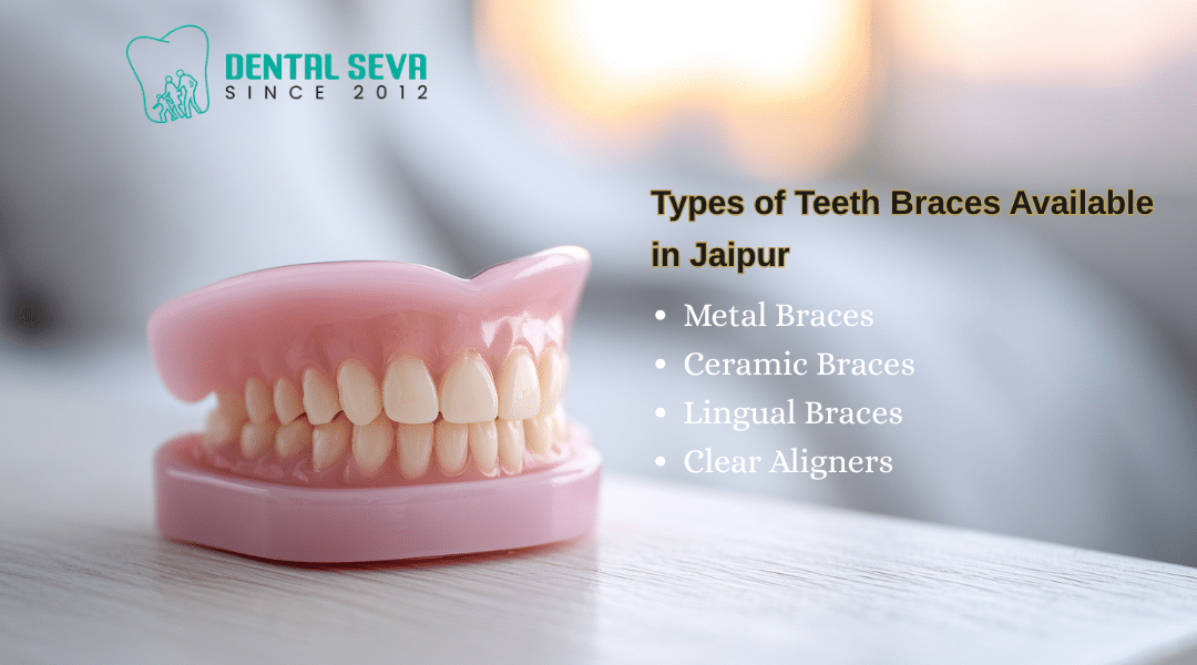 Types of Teeth Braces Available in Jaipur