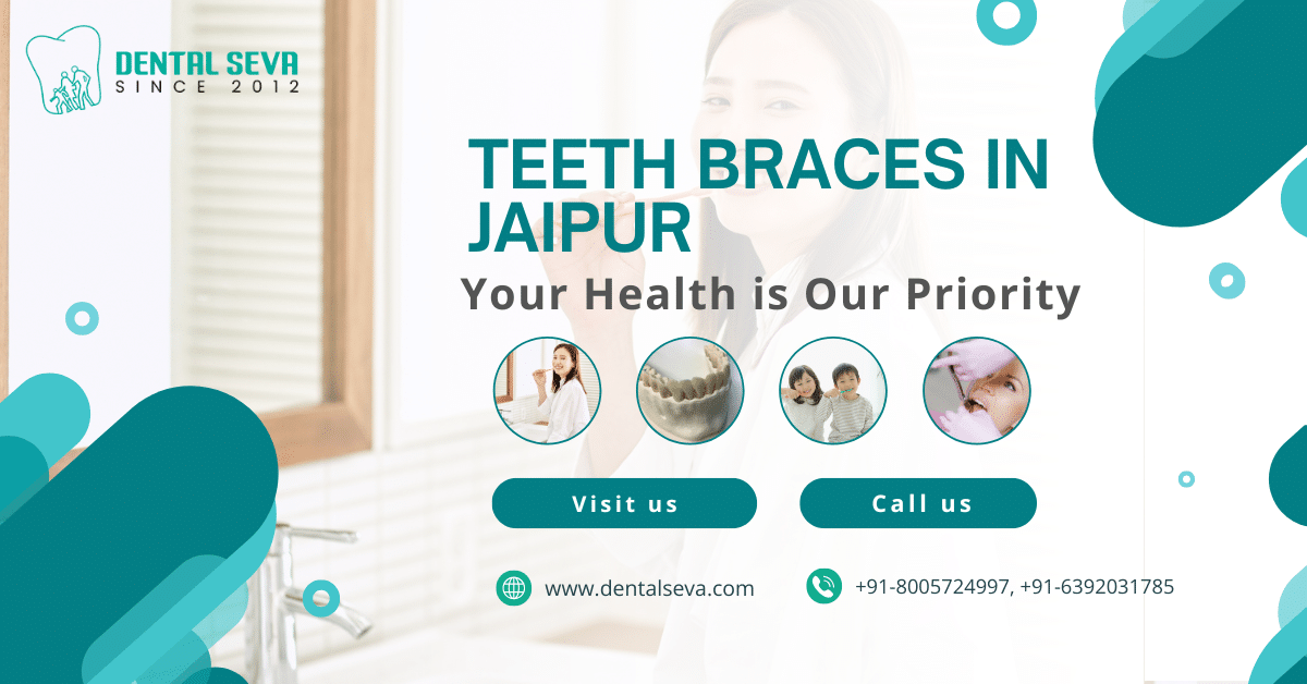 Teeth Braces in Jaipur