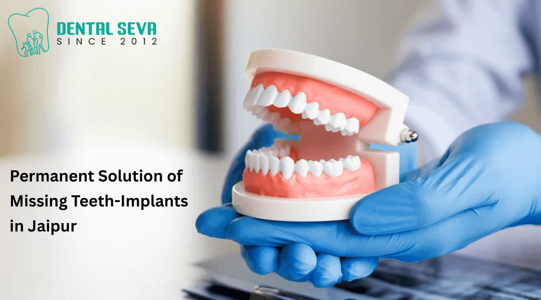 Teeth-Implants in Jaipur