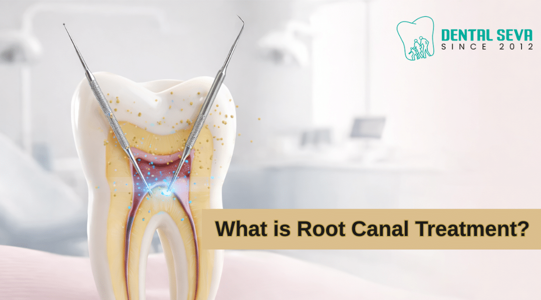 What is Root Canal Treatment?